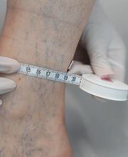 Knöchelmessung Angiologie Pratteln