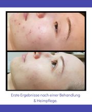 Beautyflash by Andrea Canini Bild 3