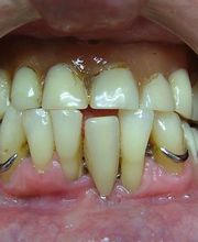 Clínica Implanteoral Milladoiro imagen 15