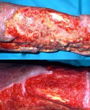 Consulta Barreiro-Vascular (Drs. A. Barreiro Mouro y J. Barreiro Veiguela) imagen 14