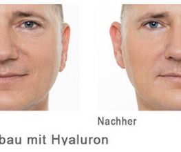 Aesthetic Dream by Dr. Cyrus Moghaddam Privatpraxis für Ästhetische Medizin & Kosmetische Chirurgie Bild 14