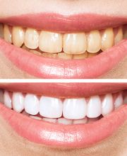 Smiles By Morel image 7