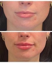 Truly Lifted MedSpa image 7