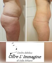 Centro Estetico Oltre L'Immagine di Lidia Schiavo Bild 11