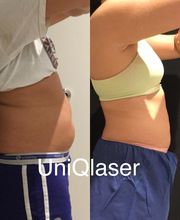 UniQ Laser Center Watertown image 1