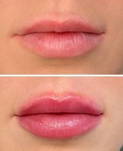 LivingYoung Center for Health & Anti-Aging image 7