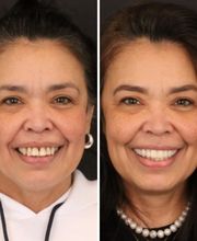 Britely Dentures + Implants Studio image 7