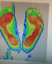 BALKE Sportorthopädie & Maßschuhatelier Bild 9