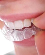 Clínica Dental Santa Eulàlia imagen 17