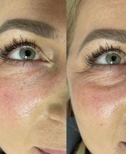 Kosmetikstudio ÄsthetikFee Bild 8