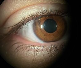 Optique Dormans image 1