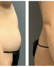 Ethos Plastic Surgery: Ginger Xu, M.D. image 15