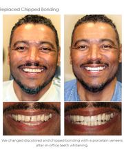 The Dental Design Center - Cosmetic, Implant & General Dentistry image 4