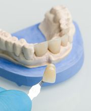 Dentallabor Gunzelmann Bild 2