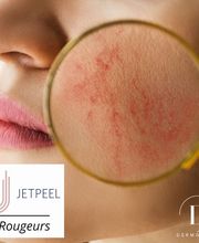 Dermopeel image 7