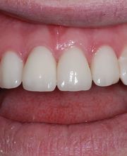 Bodensee Implantatzentrum Dr. Wolfgang Prinz MDSc Zahnarzt/ Implantologie Bild 3