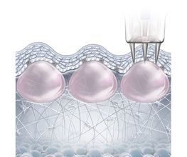 Lignon Esthétique - Institut de Beauté Bild 4