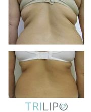 Endermospa image 3