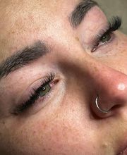 Volumenverlängerung