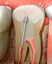 Neric Médecine dentaire I Zahnmedizin Bild 6