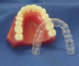 Invisalign