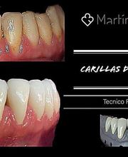 Clínica Dental Reina Victoria 66 imagen 18