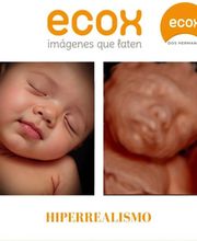 Ecox Dos Hermanas, Sevilla Especialistas en ecografías 5D, 4D y 8K imagen 7