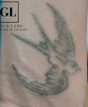 eliminacion-tatuajes-pontevedra.jpeg