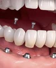 CLINICA DENTAL CEID imagen 12