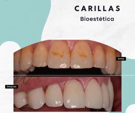 dentetes_dentista3.jpeg