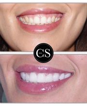 Carlos Saiz Smile imagen 2