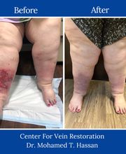Center for Vein Restoration | Dr. Mohamed Hassan image 19