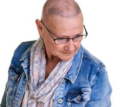 Alopecia Totalis