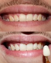 MyPlace Zug - Kosmetikstudio in Rotkreuz Bild 2