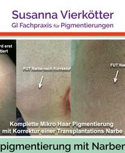 Microhaar Pigmentierung 061