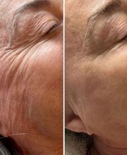 Wrinkle Free WA image 10