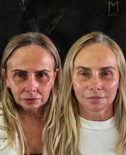 Instituto Marzola | Harmonização Facial imagen 17
