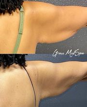 Grace Medspa & Body Solutions image 6