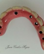 Laboratorio Dental J C imagen 2