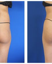 Ethos Plastic Surgery: Ginger Xu, M.D. image 2