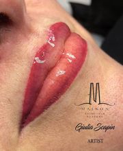 Gallery Cliente