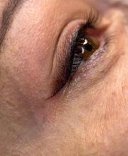 Micropigmentación para tí imagen 18