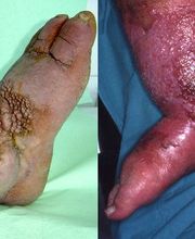 Consulta Barreiro-Vascular (Drs. A. Barreiro Mouro y J. Barreiro Veiguela) imagen 13