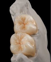 Palm Zahntechnik Inh. Sebastian Palm Bild 5