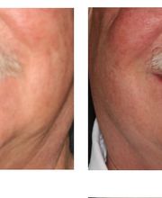 Aspen Ridge Dental image 13