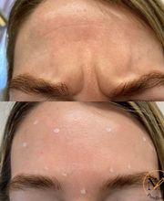 PureBeautyNP Aesthetics image 4