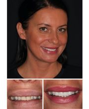 The Dental Design Center - Cosmetic, Implant & General Dentistry image 17