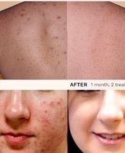 Grace Medspa & Body Solutions image 8