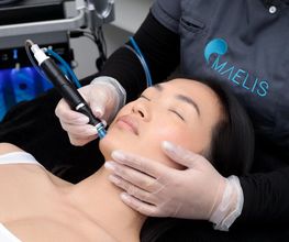 Maelis Centre Laser Antony image 18