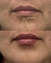 Dr Alexis Fernandez | Medicina Estetica imagen 8